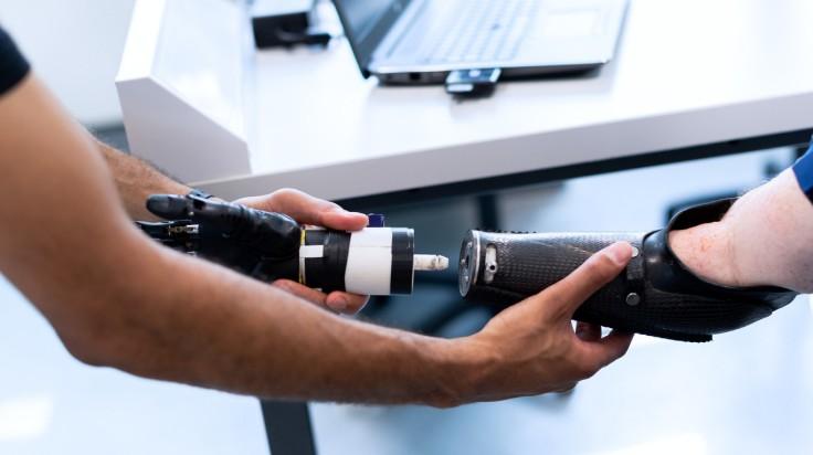 Learn how prosthetics can transform disabilities into opportunities for patients