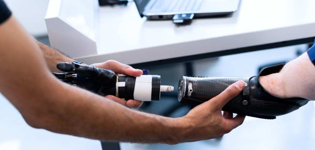 Learn how prosthetics can transform disabilities into opportunities for patients